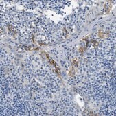 抗-CLDN18 兔抗 Prestige Antibodies® Powered by Atlas Antibodies, affinity isolated antibody, buffered aqueous glycerol solution