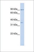 Anti-NFATC1 (ab1) antibody produced in rabbit affinity isolated antibody