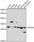 Anti-PDCD10 antibody produced in rabbit