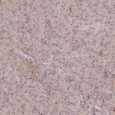 Anti-GBE1 antibody produced in rabbit Prestige Antibodies® Powered by Atlas Antibodies, affinity isolated antibody, buffered aqueous glycerol solution