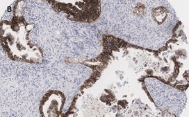 Anti-EpCAM Antibody, clone 1B8 , ZooMAb® Rabbit Monoclonal recombinant, expressed in HEK 293 cells