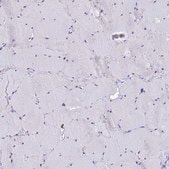 Anti-ACTL6B antibody produced in rabbit Prestige Antibodies® Powered by Atlas Antibodies, affinity isolated antibody, buffered aqueous glycerol solution