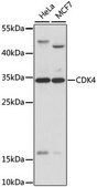 Anti-CDK4 antibody produced in rabbit