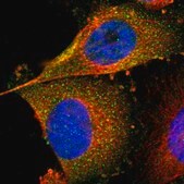 抗-FER 兔抗 affinity isolated antibody, buffered aqueous glycerol solution