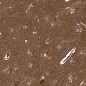 Anti-ATP6V1H antibody produced in rabbit Prestige Antibodies® Powered by Atlas Antibodies, affinity isolated antibody, buffered aqueous glycerol solution