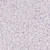 Anti-STK39 antibody produced in rabbit Prestige Antibodies® Powered by Atlas Antibodies, affinity isolated antibody, buffered aqueous glycerol solution