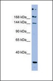 Anti-APOB antibody produced in rabbit affinity isolated antibody