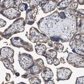 Anti-UPF1 antibody produced in rabbit Prestige Antibodies® Powered by Atlas Antibodies, affinity isolated antibody, buffered aqueous glycerol solution, Ab2