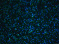 OSUMMER.1 Mouse NRAS-Mutant Melanoma Cell Line