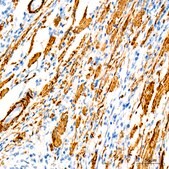 Anti-SMMHC/MYH11 Antibody, clone 0O4O4, Rabbit Monoclonal