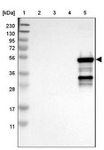 Anti-CYP2C9 antibody produced in rabbit Prestige Antibodies® Powered by Atlas Antibodies, affinity isolated antibody, buffered aqueous glycerol solution