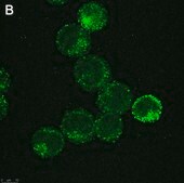 Anti-IL-6 Antibody, clone 3B9 ZooMAb® Rabbit Monoclonal recombinant, expressed in HEK 293 cells