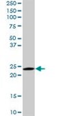 Monoclonal Anti-RAB6A antibody produced in mouse clone 3G3, purified immunoglobulin, buffered aqueous solution