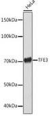 Anti-TFE3 antibody produced in rabbit