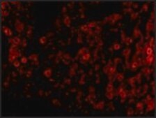 Anti-PKR antibody produced in rabbit affinity isolated antibody, buffered aqueous solution