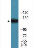 Anti-phospho-HDAC5 (pSer259) antibody produced in rabbit affinity isolated antibody