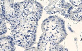 Anti-Laminin β1 Antibody, clone 4E10 ZooMAb® Mouse Monoclonal recombinant, expressed in HEK 293 cells