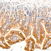 Anti-ROCK2 Antibody, clone 8G3U2, Rabbit Monoclonal