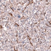 Anti-MCAM antibody produced in mouse Prestige Antibodies® Powered by Atlas Antibodies, clone CL12855, purified by using Protein A, buffered aqueous glycerol solution