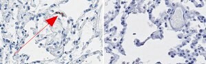 Anti-ACE2-cytoplasmic Antibody, clone 1C17 ZooMAb® Rabbit Monoclonal recombinant, expressed in HEK 293 cells