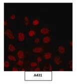 Anti-JHDM1B Antibody from rabbit, purified by affinity chromatography