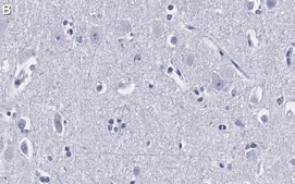 Anti-Ago2 Antibody, clone 2H10 ZooMAb® Rabbit Monoclonal recombinant, expressed in HEK 293 cells
