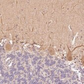 Anti-PPP1R1B antibody produced in rabbit Prestige Antibodies® Powered by Atlas Antibodies, affinity isolated antibody, buffered aqueous glycerol solution