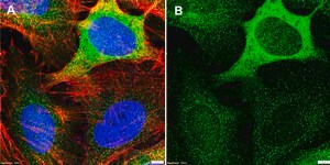 Anti-Stathmin Antibody, clone 1F5 ZooMAb® Rabbit Monoclonal recombinant, expressed in HEK 293 cells