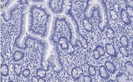 Anti-ATM Antibody, clone 4N19, ZooMAb® Rabbit Monoclonal recombinant, expressed in HEK 293 cells