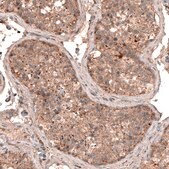 Monoclonal Anti-LAPTM4B antibody produced in mouse Prestige Antibodies® Powered by Atlas Antibodies, clone CL5287, purified immunoglobulin, buffered aqueous glycerol solution