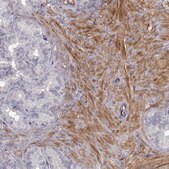 Anti-PGM5 Prestige Antibodies® Powered by Atlas Antibodies, affinity isolated antibody