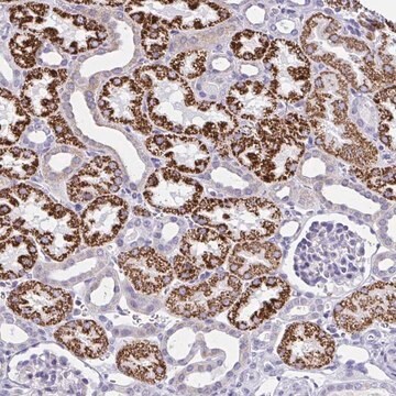 Anti-RNF183 antibody produced in rabbit Prestige Antibodies® Powered by Atlas Antibodies, affinity isolated antibody, buffered aqueous glycerol solution