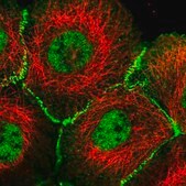 Anti-AFDN antibody produced in rabbit Prestige Antibodies® Powered by Atlas Antibodies, affinity isolated antibody, buffered aqueous glycerol solution, ab1