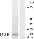 Anti-Stathmin 1 antibody produced in rabbit affinity isolated antibody