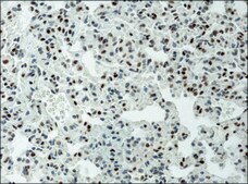 Anti-acetyl-Histone H3 (Ac-Lys9) antibody produced in rabbit 2-2.5 mg/mL, affinity isolated antibody, buffered aqueous solution