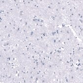 Monoclonal Anti-PNMT antibody produced in mouse Prestige Antibodies® Powered by Atlas Antibodies, clone CL11434, purified antibody (Protein A)