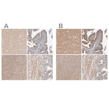 Anti-MPRIP antibody produced in rabbit Prestige Antibodies® Powered by Atlas Antibodies, affinity isolated antibody, buffered aqueous glycerol solution, Ab1