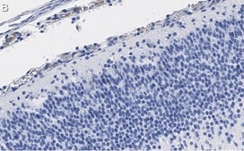 Anti-Reelin Antibody, clone G10 ZooMAb® Mouse Monoclonal recombinant, expressed in HEK 293 cells