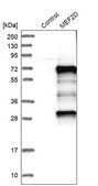 Anti-MEF2D antibody produced in rabbit Ab1, Prestige Antibodies® Powered by Atlas Antibodies, affinity isolated antibody, buffered aqueous glycerol solution