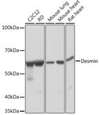 Anti-Desmin Antibody, clone 6O9O4, Rabbit Monoclonal
