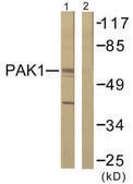 Anti-PAK1 antibody produced in rabbit affinity isolated antibody