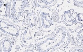 抗-磷酸组蛋白 H2A.X (Ser139) 抗体，克隆6L16, ZooMAb® 兔单克隆 recombinant, expressed in HEK 293 cells