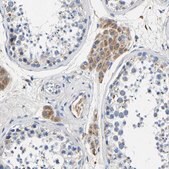 Anti-SLC25A25 antibody produced in rabbit Prestige Antibodies® Powered by Atlas Antibodies, affinity isolated antibody, buffered aqueous glycerol solution