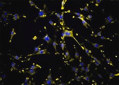 OSUMMER.6 Mouse NRAS-Mutant Melanoma Cell Line