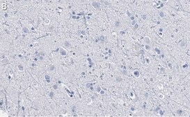 Anti-Trk-B Antibody, clone 2B22 ZooMAb® Rabbit Monoclonal recombinant, expressed in HEK 293 cells