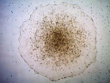 Stem Cell Qualified ECM Gel Stem cell qualified basement membrane extract (BME) for human ES and iPS cell culture.