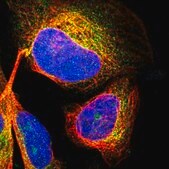 Anti-CDK5RAP3 antibody produced in rabbit Prestige Antibodies® Powered by Atlas Antibodies, affinity isolated antibody, buffered aqueous glycerol solution, Ab1