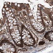 Anti-PSMB1 antibody produced in rabbit affinity isolated antibody, buffered aqueous glycerol solution, ab2