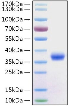Recombinant 2019-nCoV Spike RBD Protein with His tag