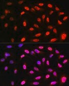 Anti-VCP antibody produced in rabbit
